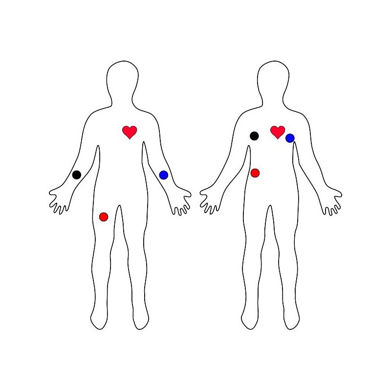 Rozmieszczenie elektrod badanie aktywności serca